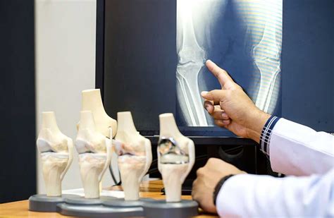 orthopedic services near hercules|Find an Orthopaedic Knee Surgeon near Hercules, CA .